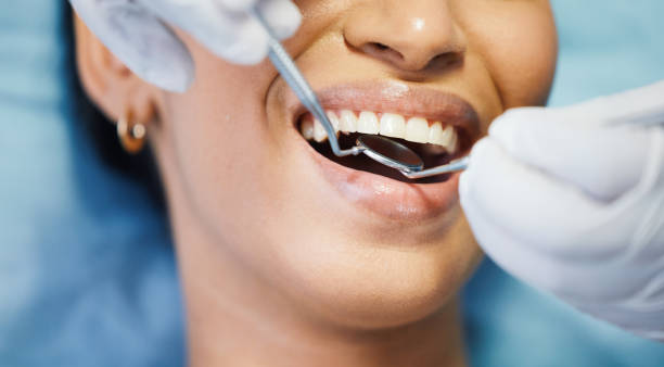 Best Emergency Tooth Extraction in Wingate, NC